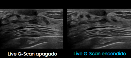 live q-scan